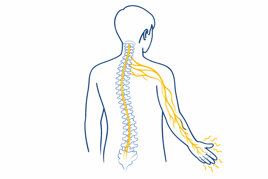 首から背骨〜腕を通り親指・人差し指へ伸びる神経の流れと、指先のしびれを示した医療系ミニマルイラスト(手のしびれ・神経圧迫の解説用